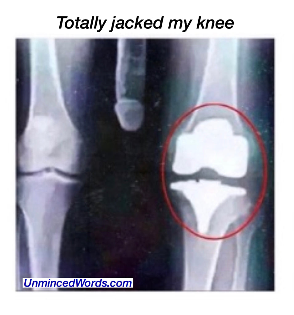 Totally jacked my knee.